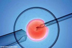 42岁成功案例